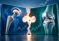 Conceptual illustration of a fractured merger between two orthopaedic implant businesses, featuring hip and knee implants.